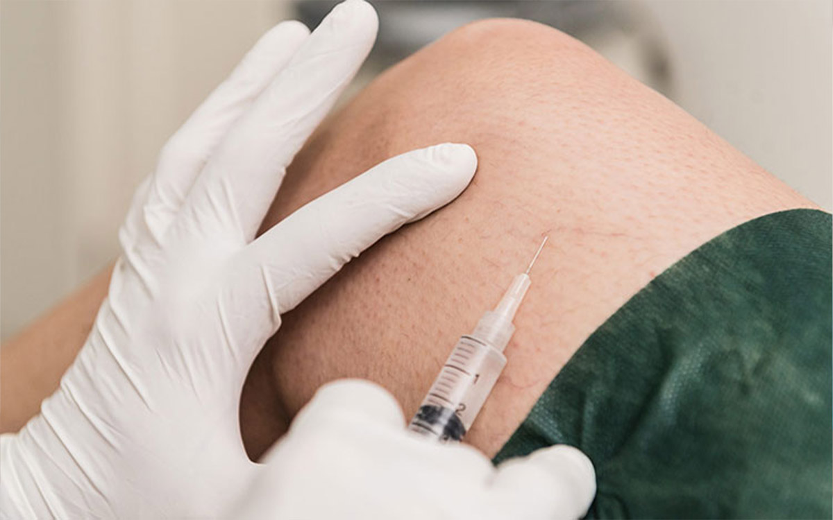 Skleroterapi ile Varis Tedavisi