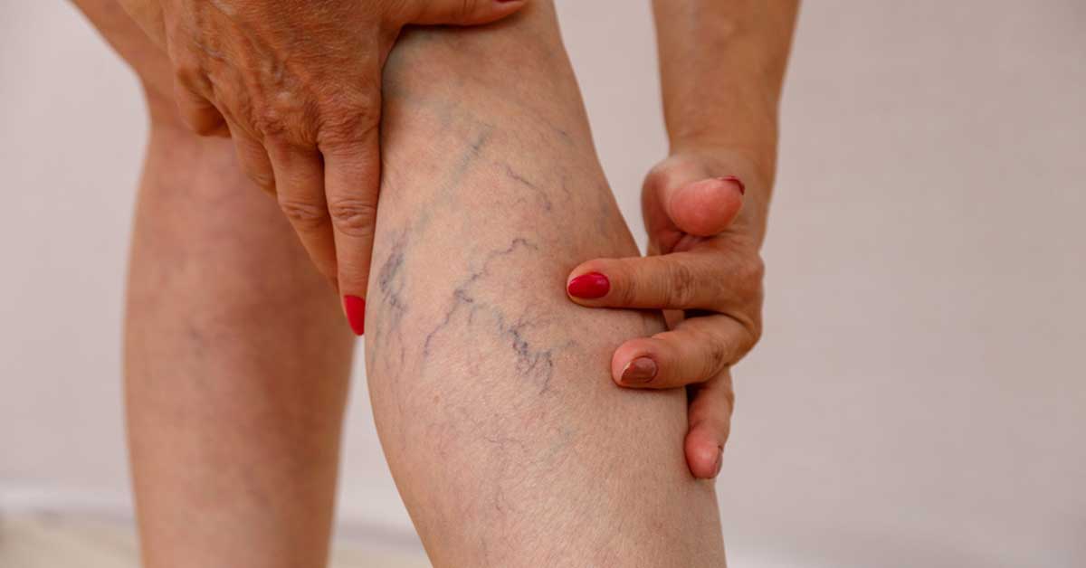 Varis Kanaması: Korkutucu Bir Senaryo