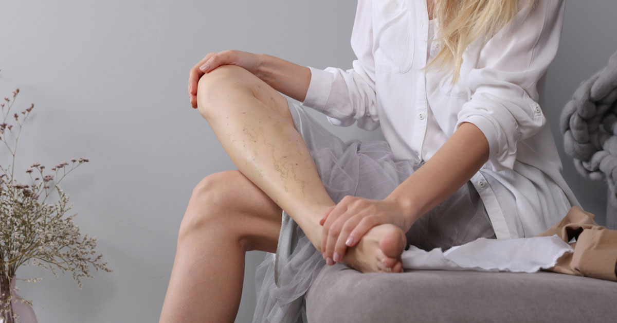 Varis Neden Kadınlarda Daha Sık Görülür?