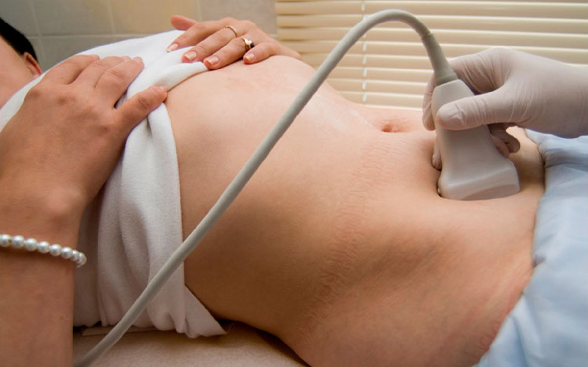 Diagnostic Methods regarding Pelvic Congestion Syndrome